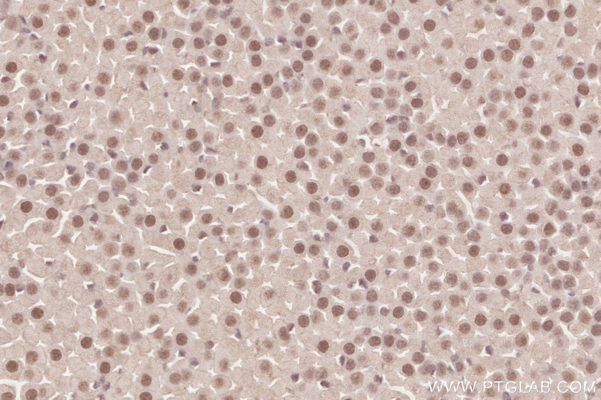 IHC staining of mouse adrenal gland using 16370-1-AP IHC staining of mouse adrenal gland using 16370-1-AP