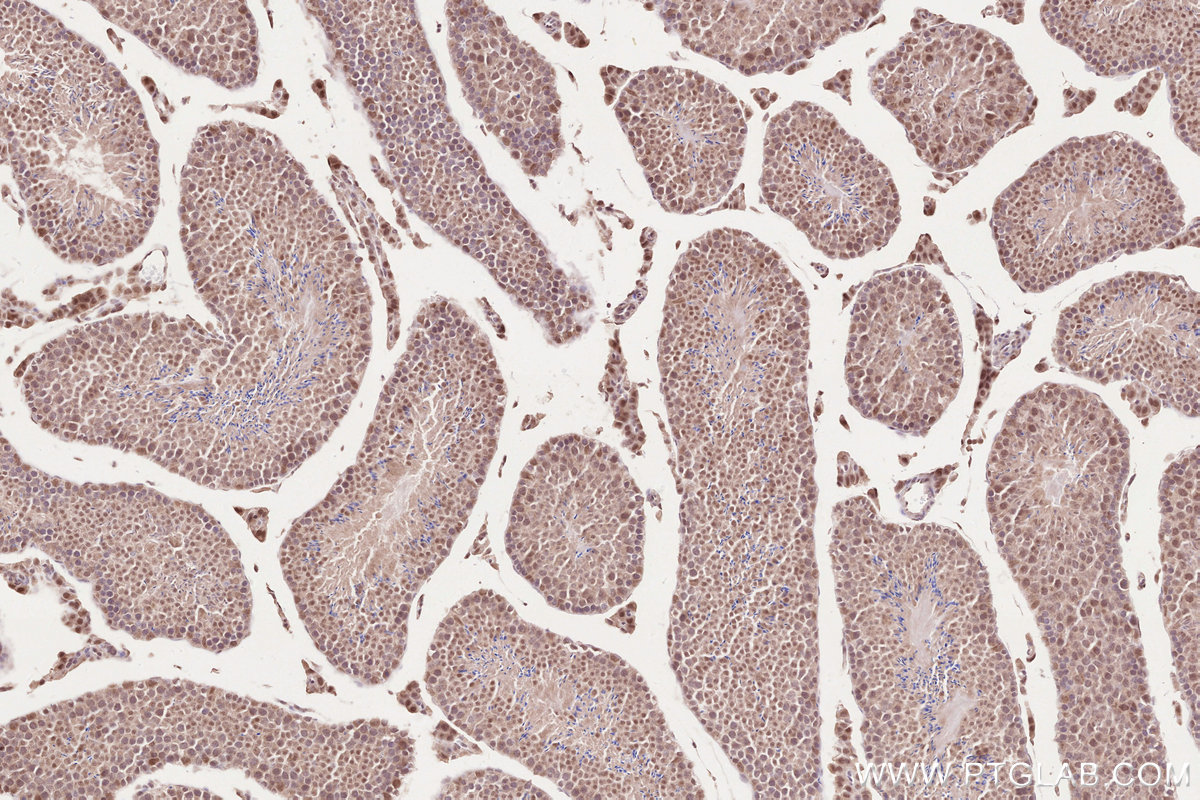 IHC staining of mouse testis using 16370-1-AP IHC staining of mouse testis using 16370-1-AP