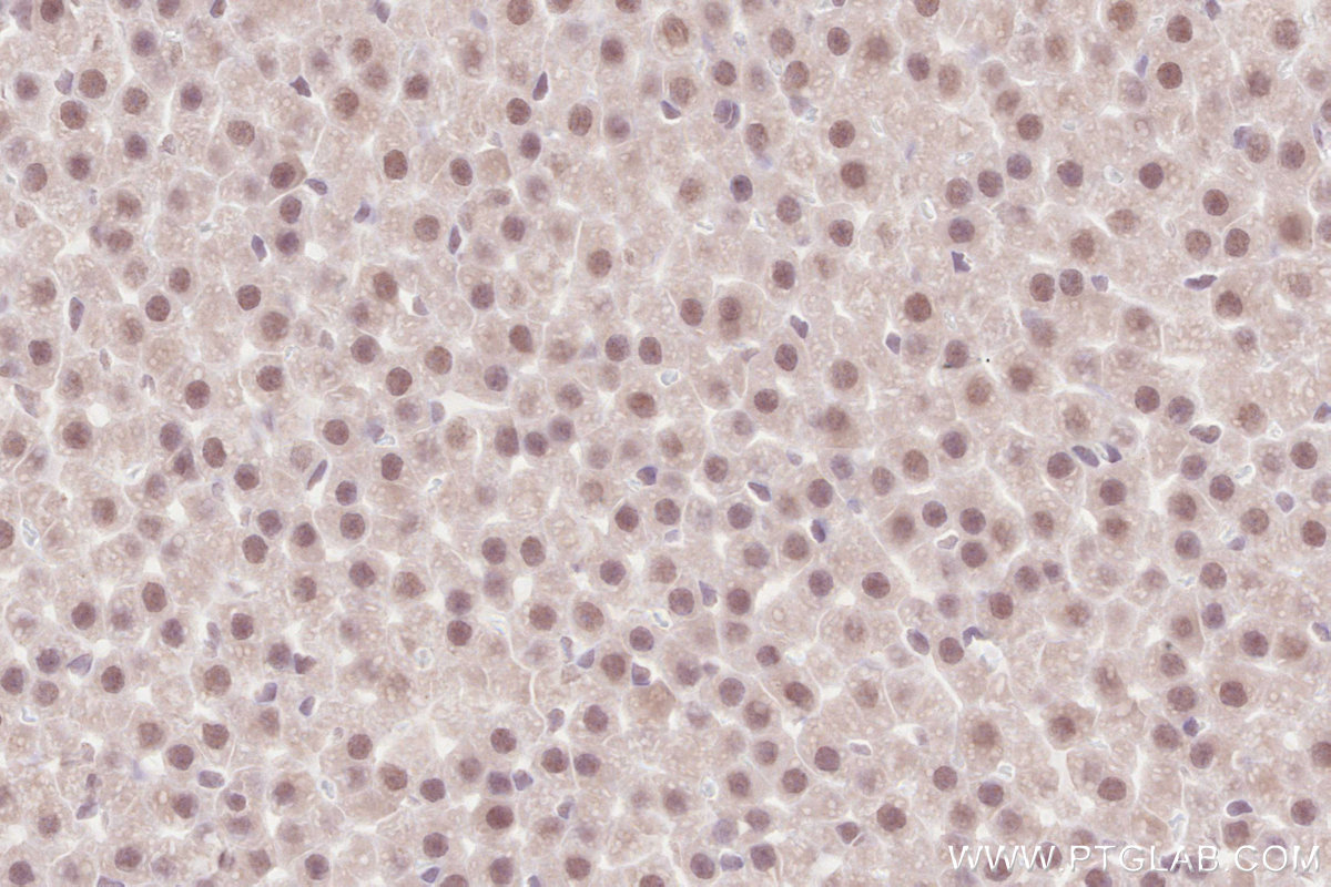 IHC staining of rat adrenal gland using 16370-1-AP IHC staining of rat adrenal gland using 16370-1-AP