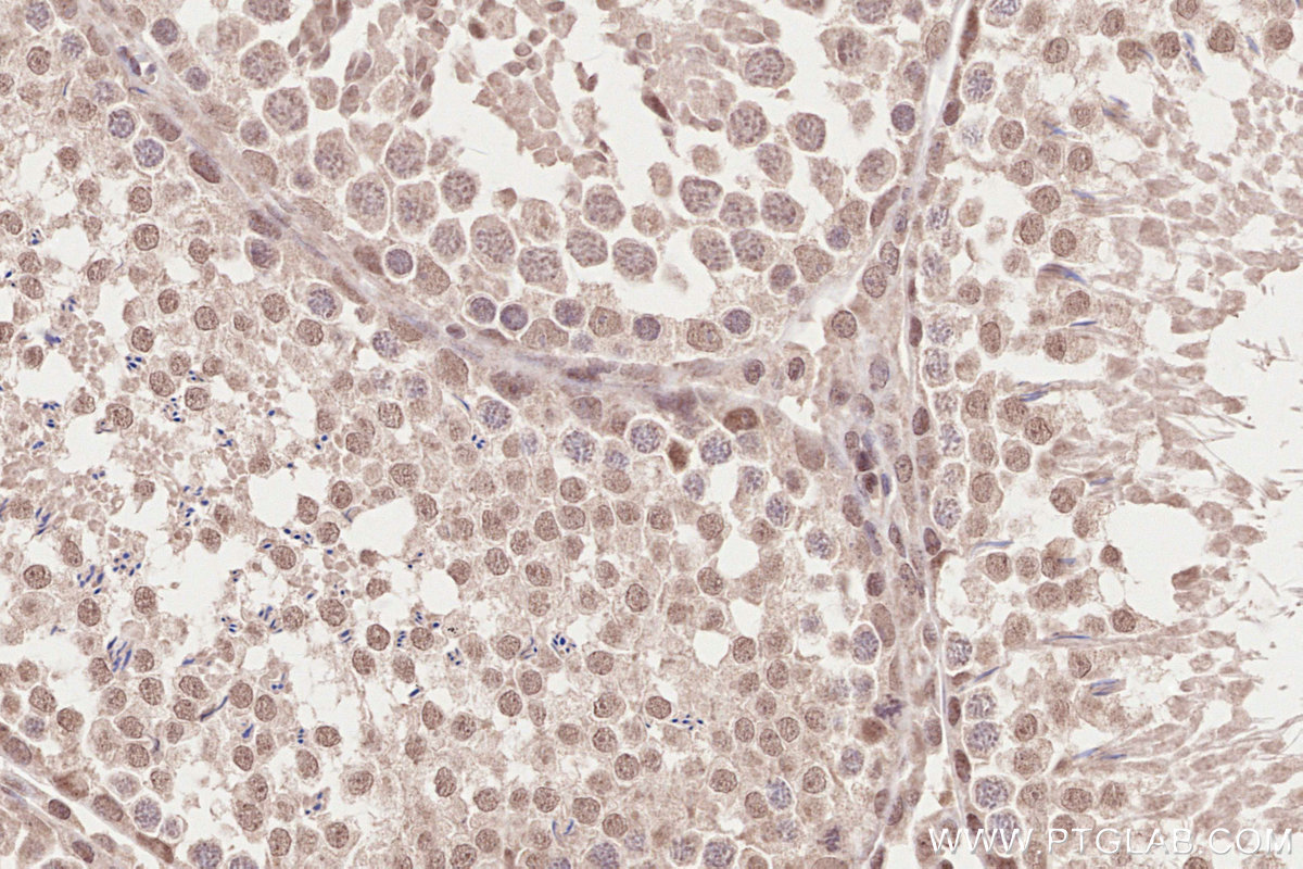 IHC staining of rat testis using 16370-1-AP IHC staining of rat testis using 16370-1-AP