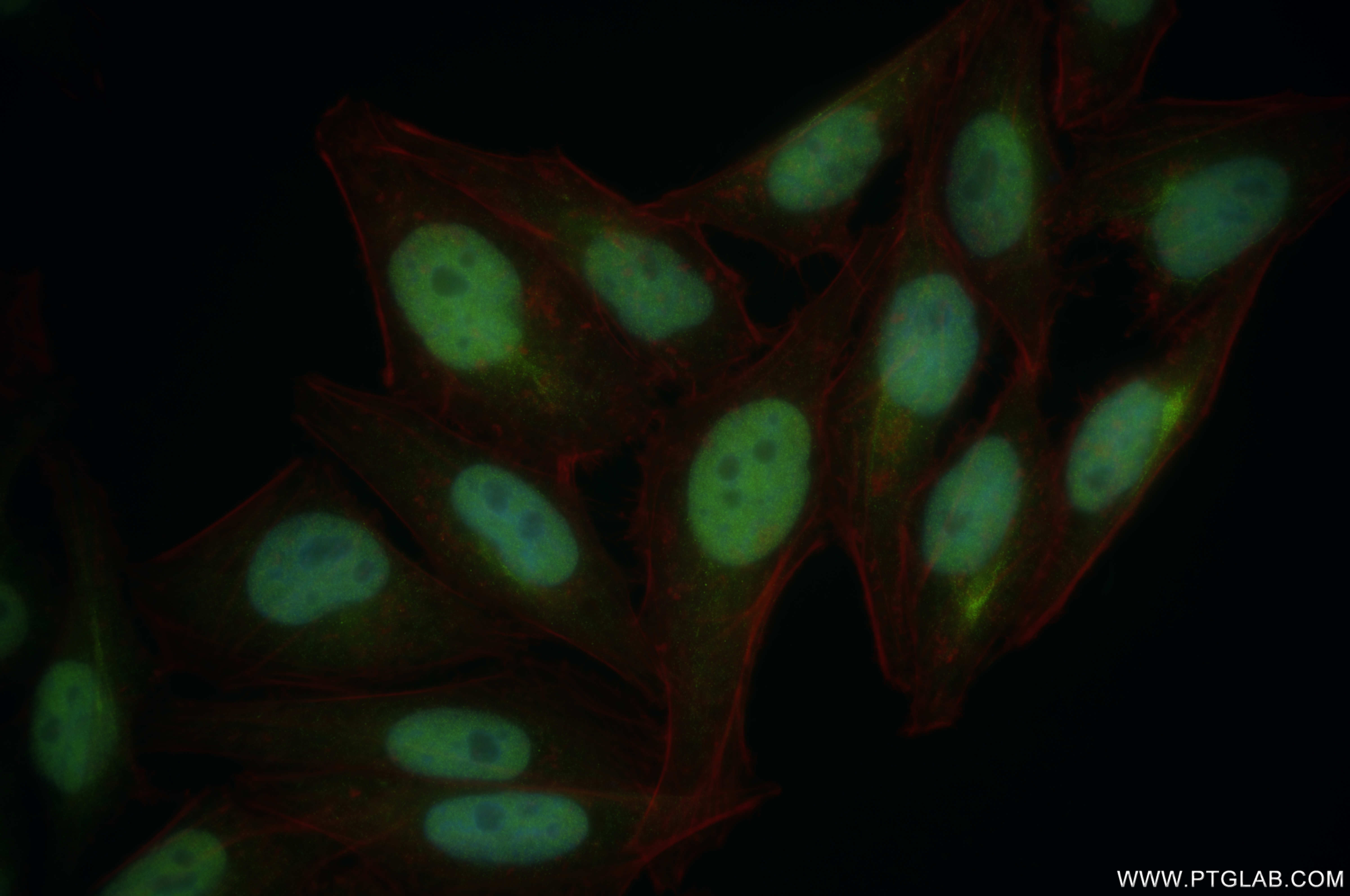 IF Staining of HepG2 using 84877-5-RR (same clone as 84877-5-PBS)