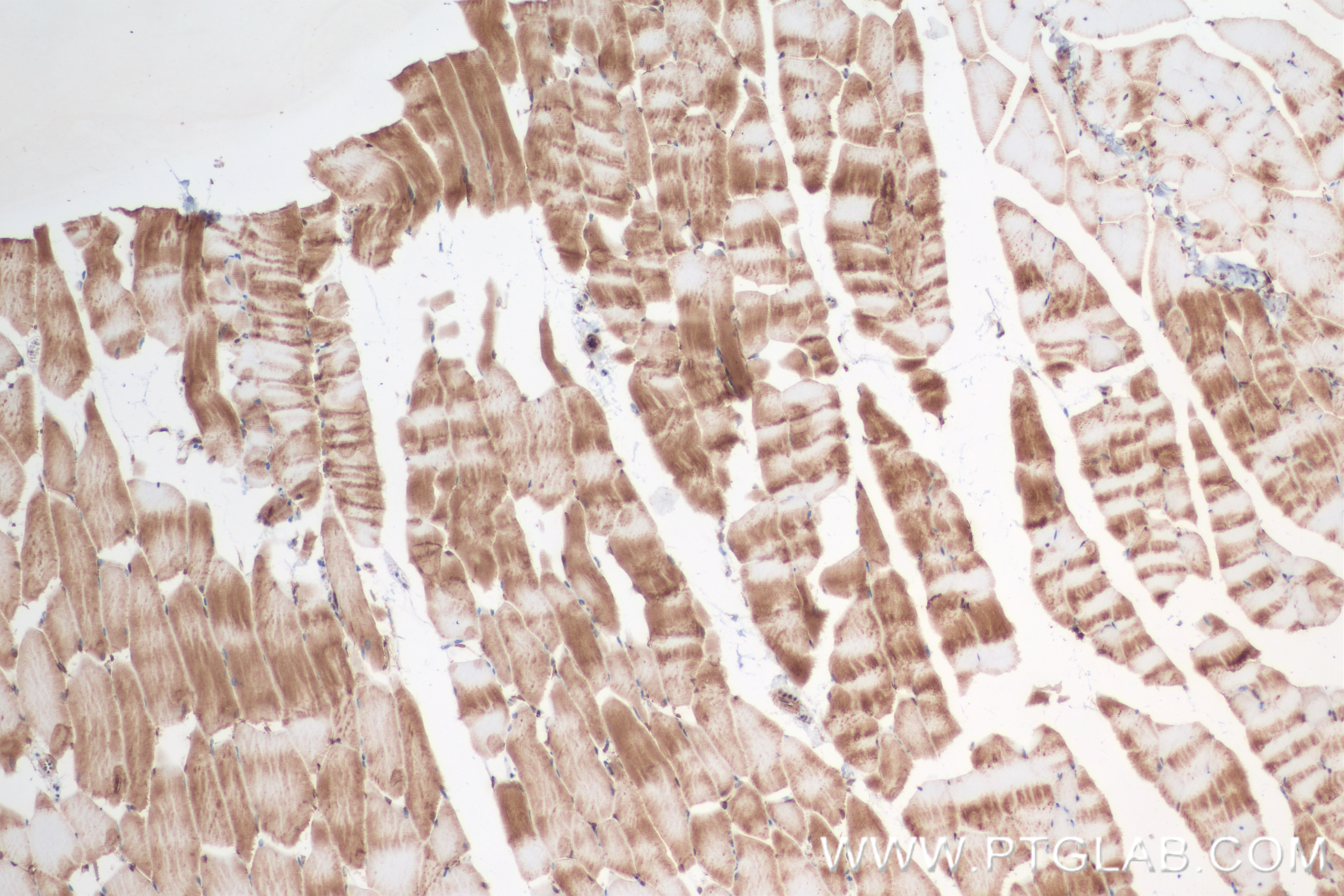 IHC staining of mouse skeletal muscle using 84877-5-RR (same clone as 84877-5-PBS)