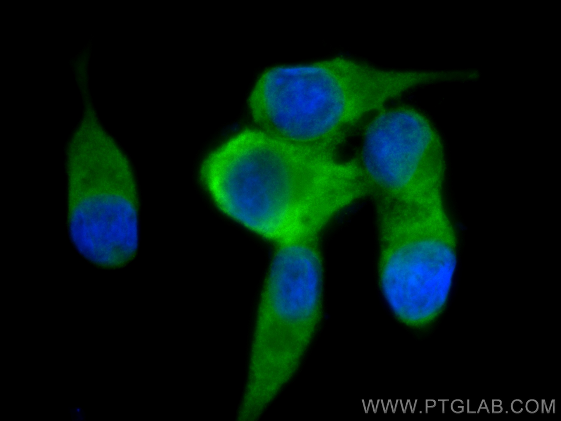 IF Staining of LNCaP using 67952-1-Ig