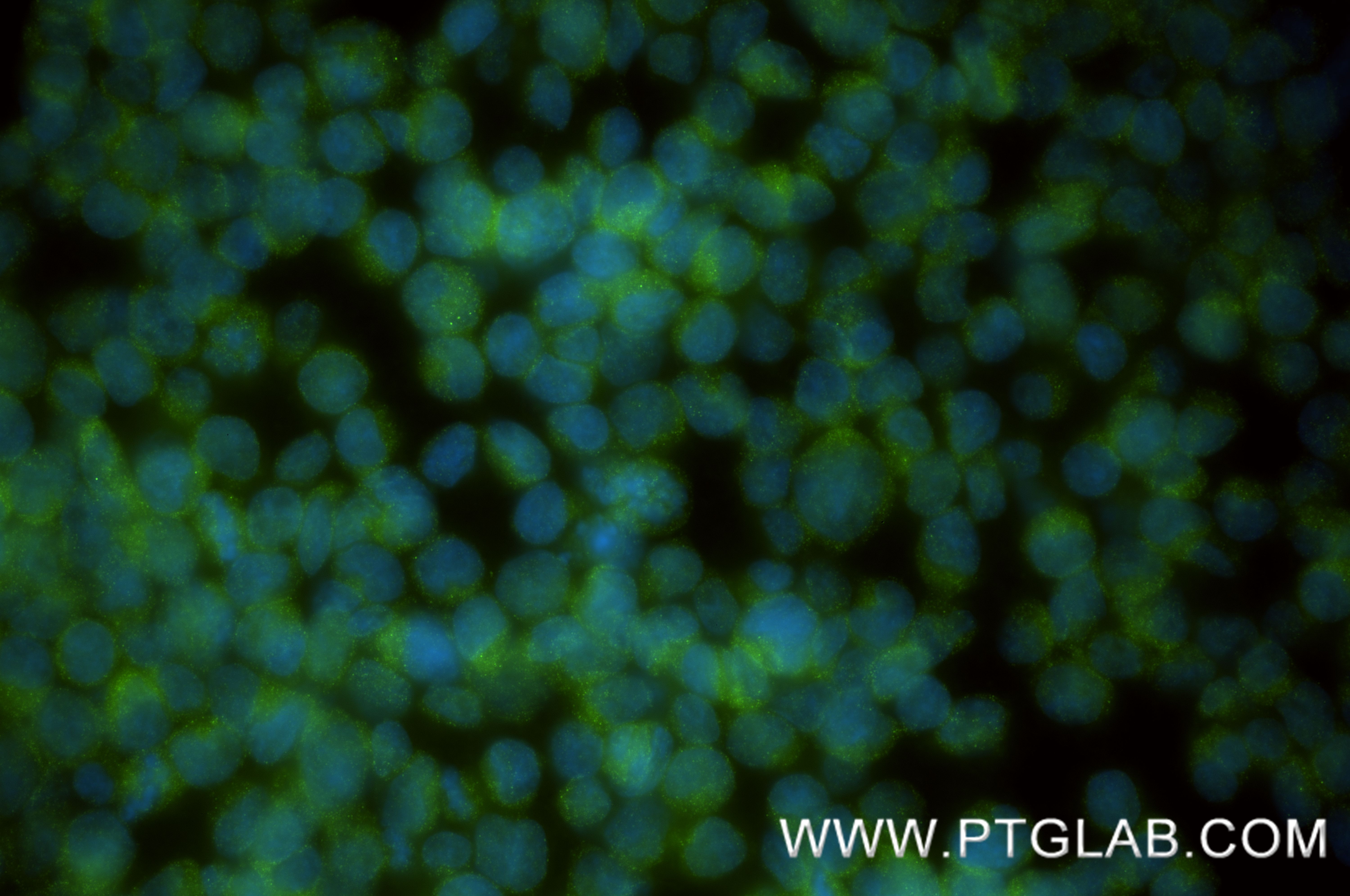 IF Staining of Jurkat using 84714-2-RR IF Staining of Jurkat using 84714-2-RR