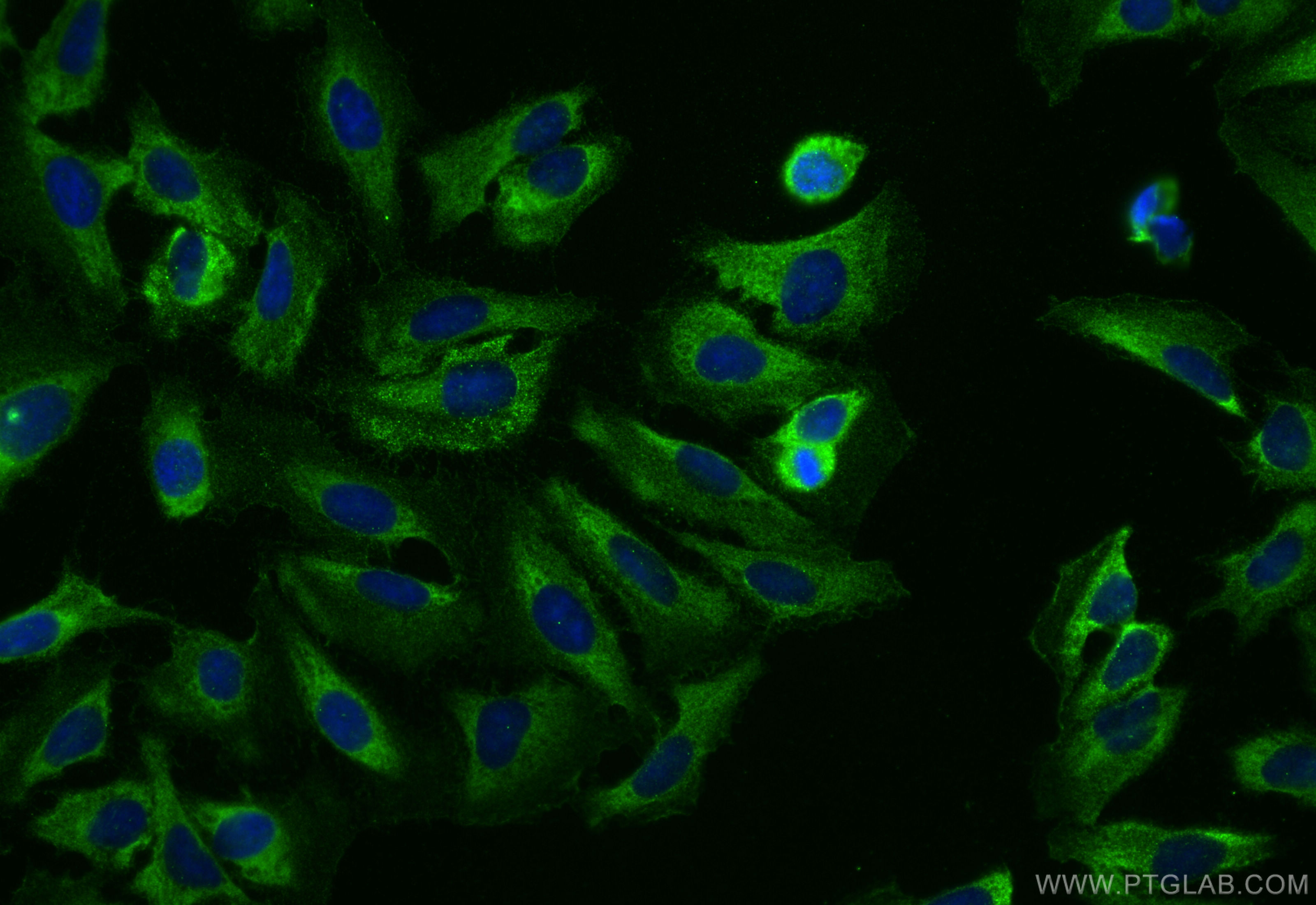 IF Staining of U2OS using 31442-1-AP