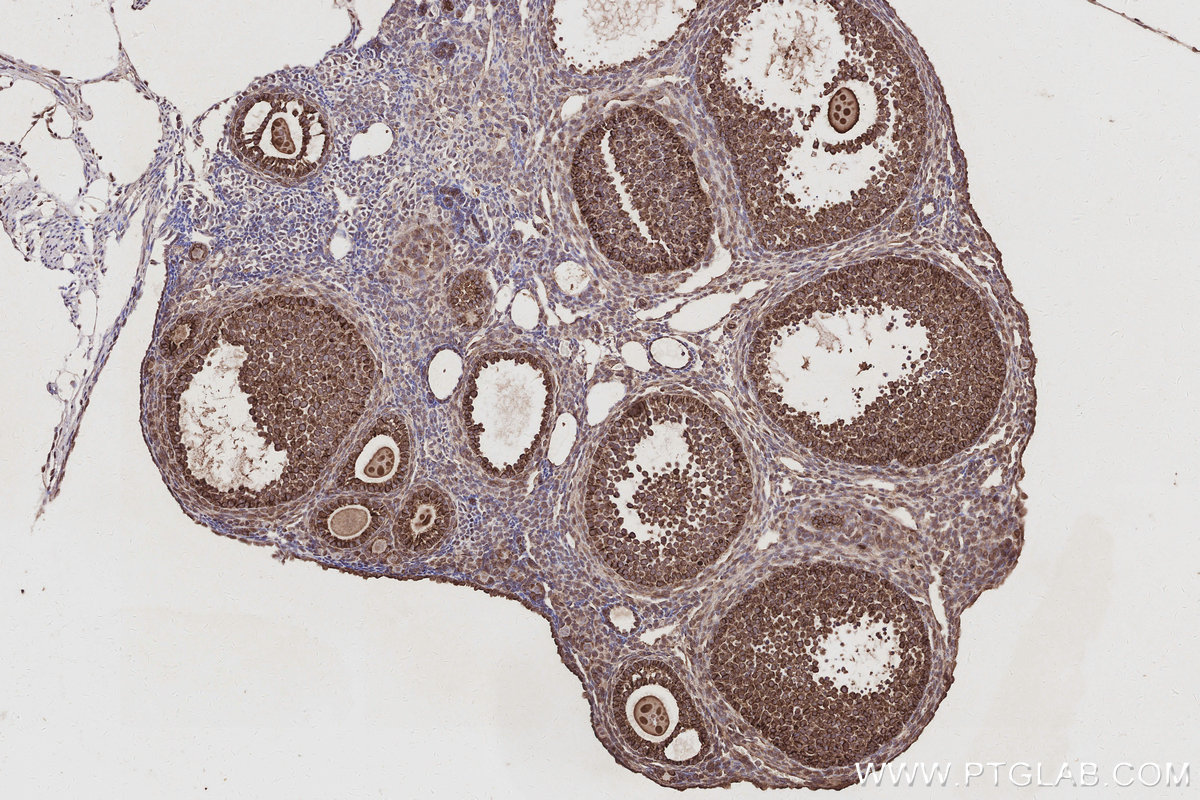 IHC staining of mouse ovary using 67620-1-Ig