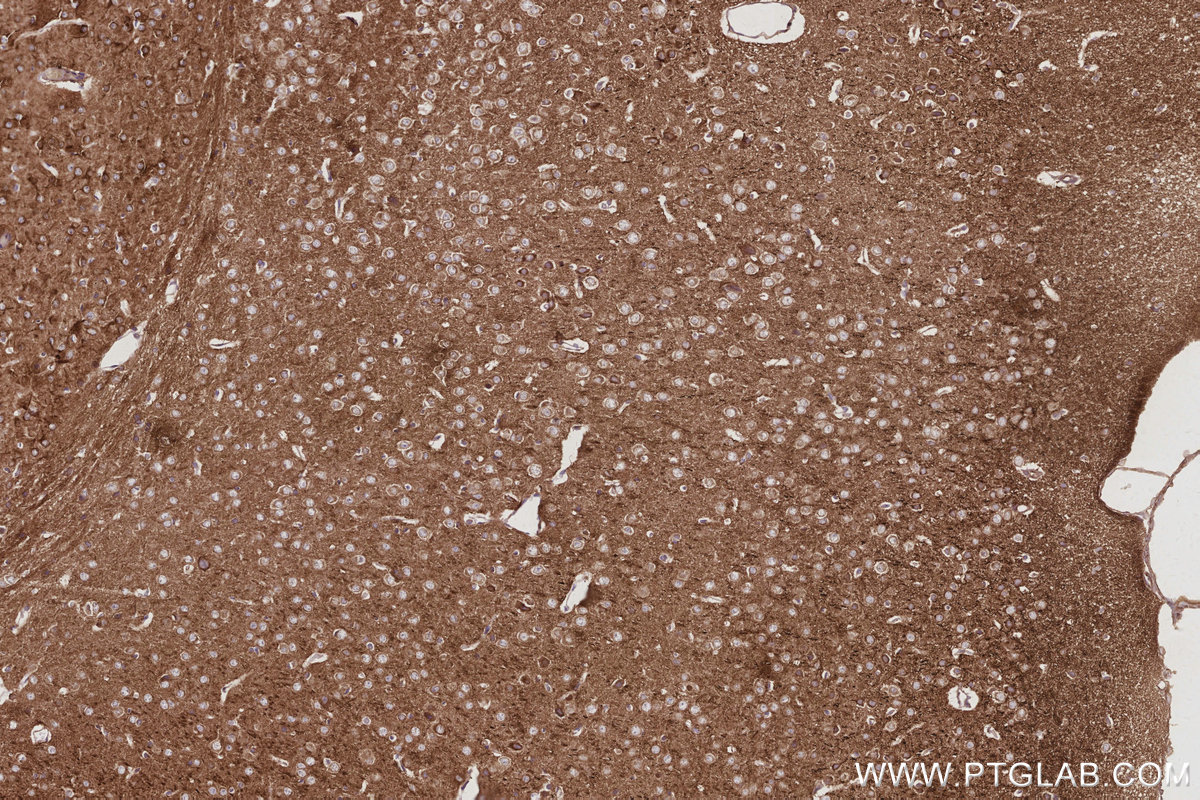 IHC staining of mouse brain using 67620-1-Ig