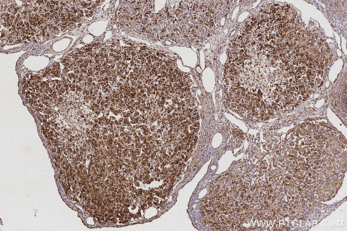 IHC staining of rat ovary using 67620-1-Ig
