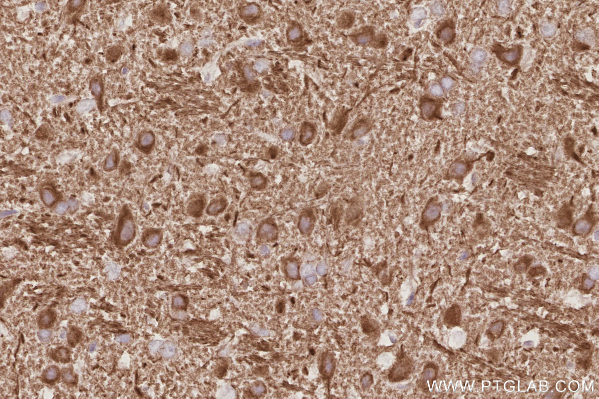 IHC staining of rat brain using 67620-1-Ig
