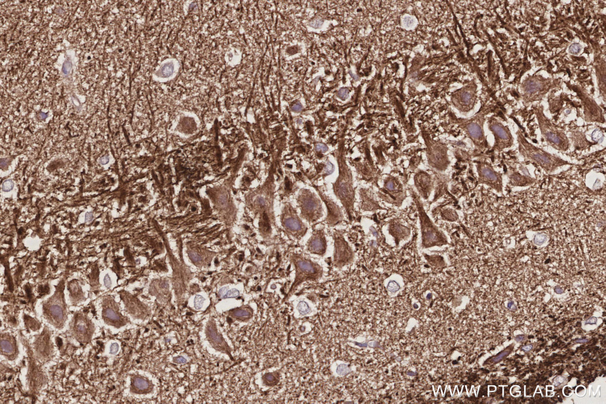 IHC staining of rat brain using 67620-1-Ig