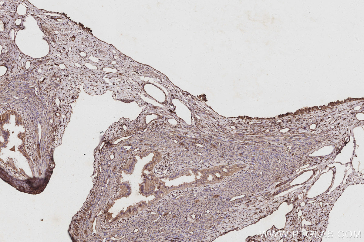 IHC staining of rat ovary using 67620-1-Ig