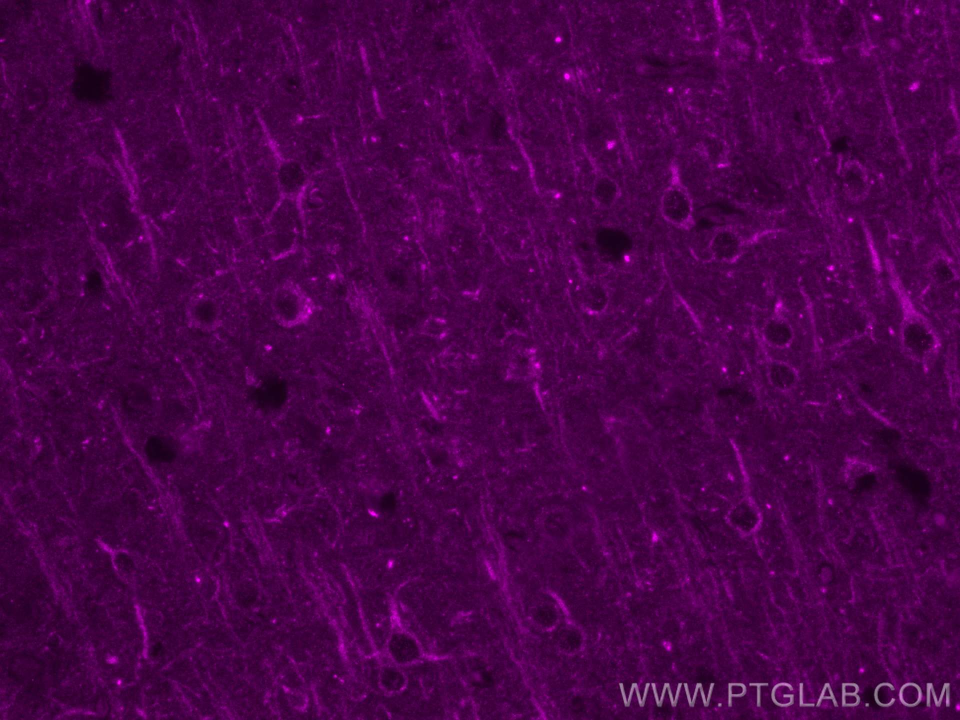 IF Staining of mouse brain using CL647-67620