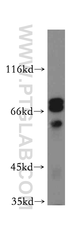 WB analysis of mouse brain using 19755-1-AP