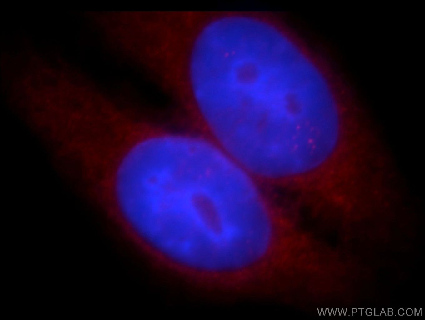 IF Staining of HepG2 using 14306-1-AP