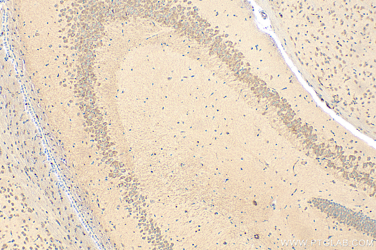 IHC staining of mouse brain using 14306-1-AP