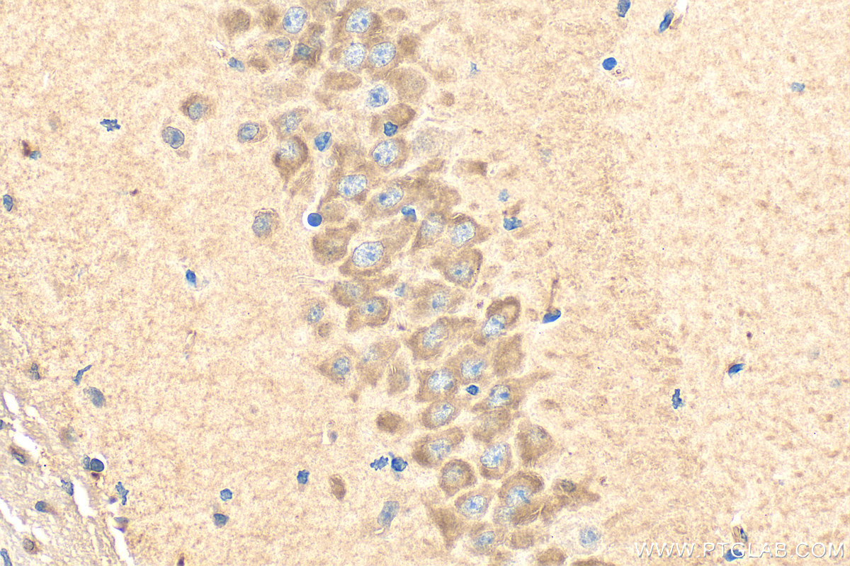 IHC staining of mouse brain using 14306-1-AP