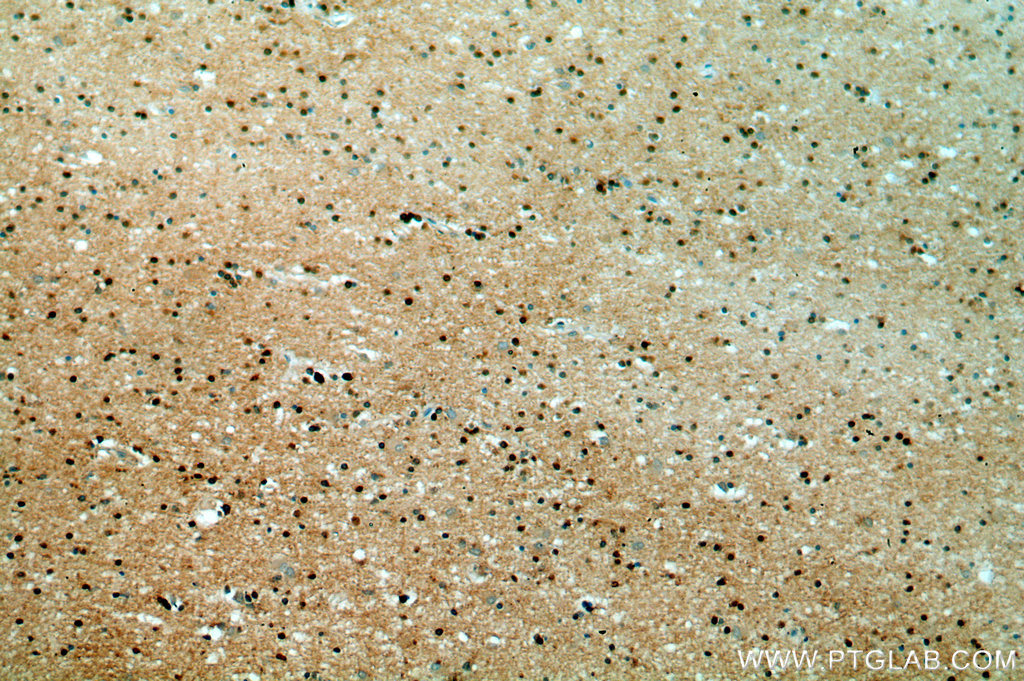 IHC staining of human brain using 14306-1-AP