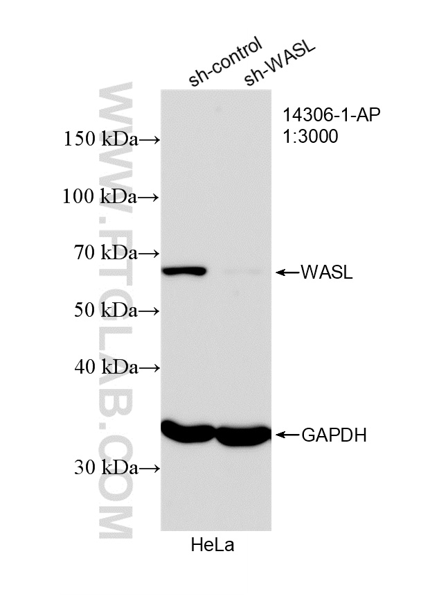 WB analysis of HeLa using 14306-1-AP WB analysis of HeLa using 14306-1-AP