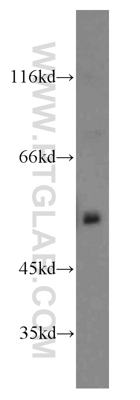 WB analysis of mouse brain using 14306-1-AP