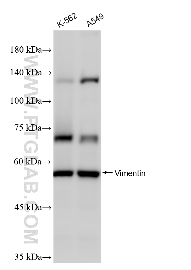 Various lysates were subjected to SDS PAGE followed by western blot with Biotin-60330 (Biotin-conjugated Vimentin Monoclonal antibody) and HRP-PF00030 (Streptavidin antibody) at dilution of 1:1000 incubated at room temperature for 1.5 hours. Various lysates were subjected to SDS PAGE followed by western blot with Biotin-60330 (Biotin-conjugated Vimentin Monoclonal antibody) and HRP-PF00030 (Streptavidin antibody) at dilution of 1:1000 incubated at room temperature for 1.5 hours.