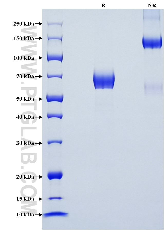 Purity of Recombinant Mouse B7-H3 was determined by SDS-PAGE. The protein was resolved in an SDS-PAGE in reducing (R) and non-reducing (NR) conditions and stained using Coomassie blue. Purity of Recombinant Mouse B7-H3 was determined by SDS-PAGE. The protein was resolved in an SDS-PAGE in reducing (R) and non-reducing (NR) conditions and stained using Coomassie blue.