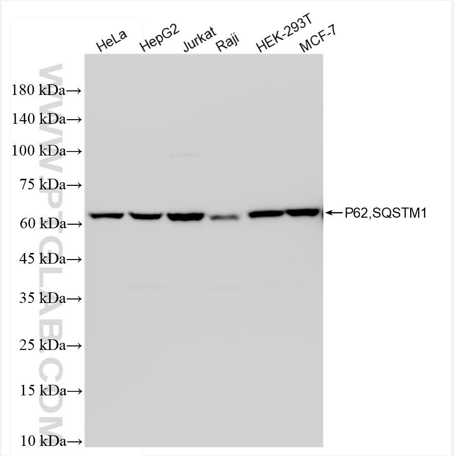 Various lysates were subjected to SDS PAGE followed by western blot with 84826-1-RR (P62,SQSTM1 antibody) at dilution of 1:5000 incubated at room temperature for 1.5 hours.
