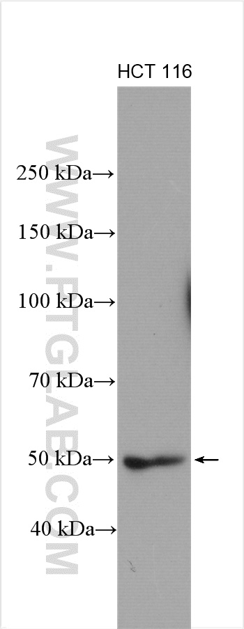 HCT 116 cells were subjected to SDS PAGE followed by western blot with 11264-1-AP (ATG12 antibody) at dilution of 1:3000 incubated at room temperature for 1.5 hours.
