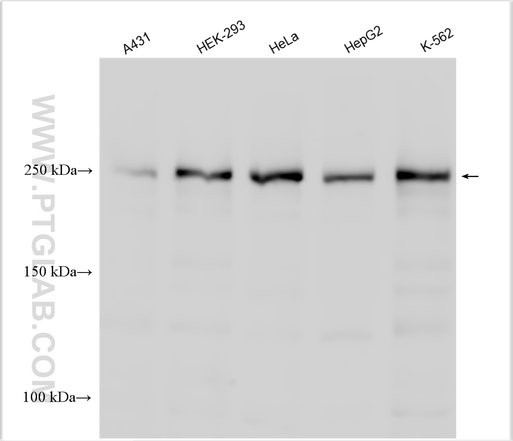 Various lysates were subjected to SDS PAGE followed by western blot with 21207-1-AP (TET2 antibody) at dilution of 1:1000 incubated at room temperature for 1.5 hours.