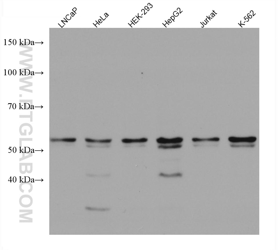 Various lysates were subjected to SDS PAGE followed by western blot with 67673-1-Ig (RNMT antibody) at dilution of 1:5000 incubated at room temperature for 1.5 hours.