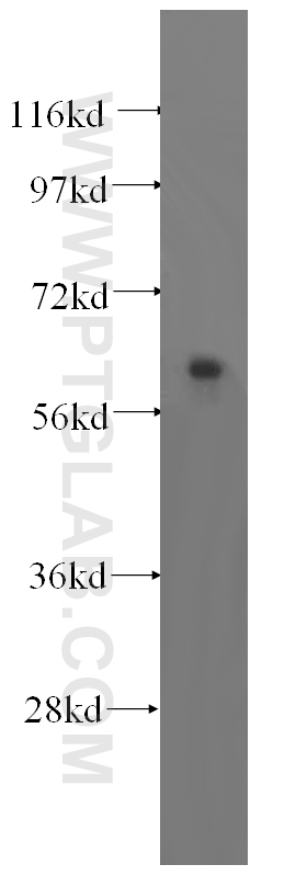 human brain tissue were subjected to SDS PAGE followed by western blot with 16727-1-AP (TRMT6 antibody) at dilution of 1:500  incubated at room temperature for 1.5 hours.