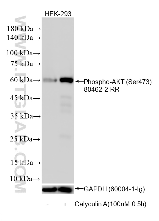 Non-treated and Calyculin A treated HEK-293 cells were subjected to SDS PAGE followed by western blot with 80462-2-RR (Phospho-AKT (Ser473) antibody) at dilution of 1:2000 incubated at room temperature for 1.5 hours. The membrane was stripped and re-blotted with GAPDH antibody (60004-1-Ig) as loading control.