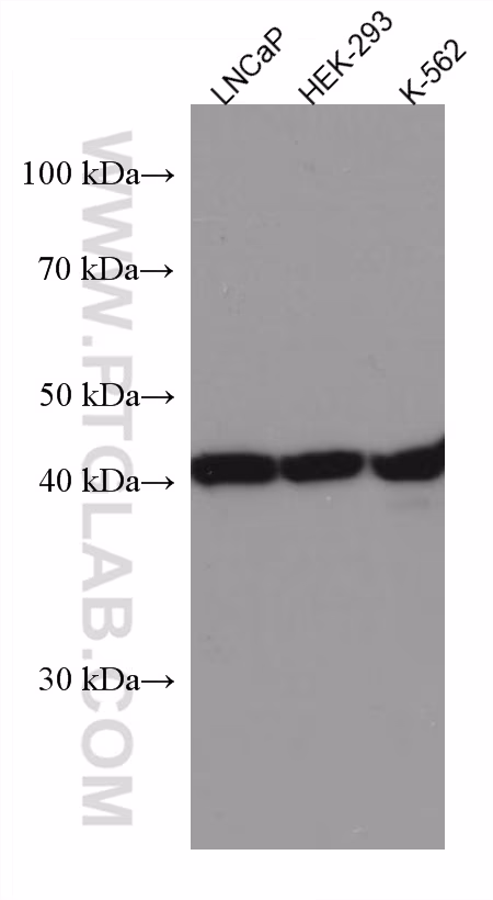 Various lysates were subjected to SDS PAGE followed by western blot with 67298-1-Ig (LIAS antibody) at dilution of 1:3000 incubated at room temperature for 1.5 hours.