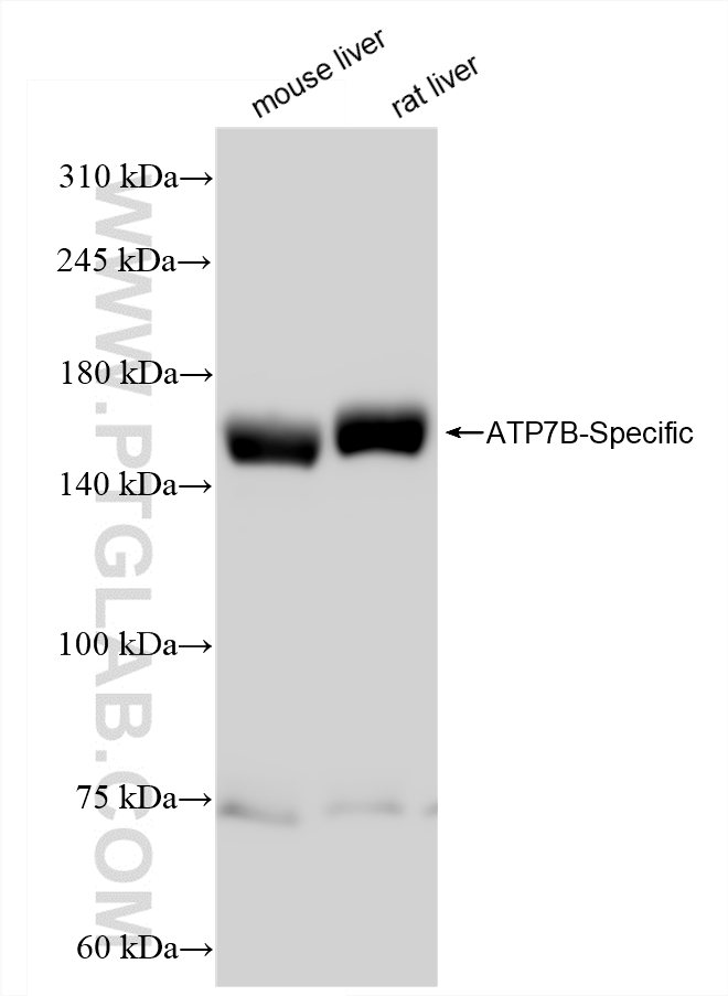 Various lysates were subjected to SDS PAGE followed by western blot with 85288-2-RR (ATP7B-Specific antibody) at dilution of 1:10000 incubated at room temperature for 1.5 hours.