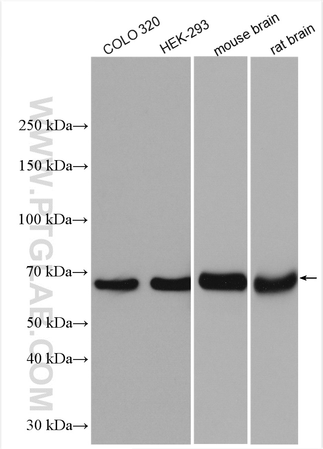 Various lysates were subjected to SDS PAGE followed by western blot with 12855-1-AP (KGA/GAC antibody) at dilution of 1:15000 incubated at room temperature for 1.5 hours.