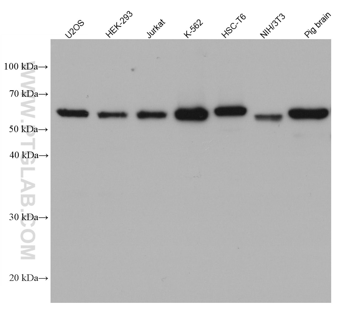 Various lysates were subjected to SDS-PAGE followed by western blot with Catalase mouse monoclonal antibody (66765-1-Ig) at 1:10000.  Multi-rAb HRP-Goat Anti-Mouse Recombinant Secondary Antibody (H+L) RGAM001 were used at 1:5000 for detection. 