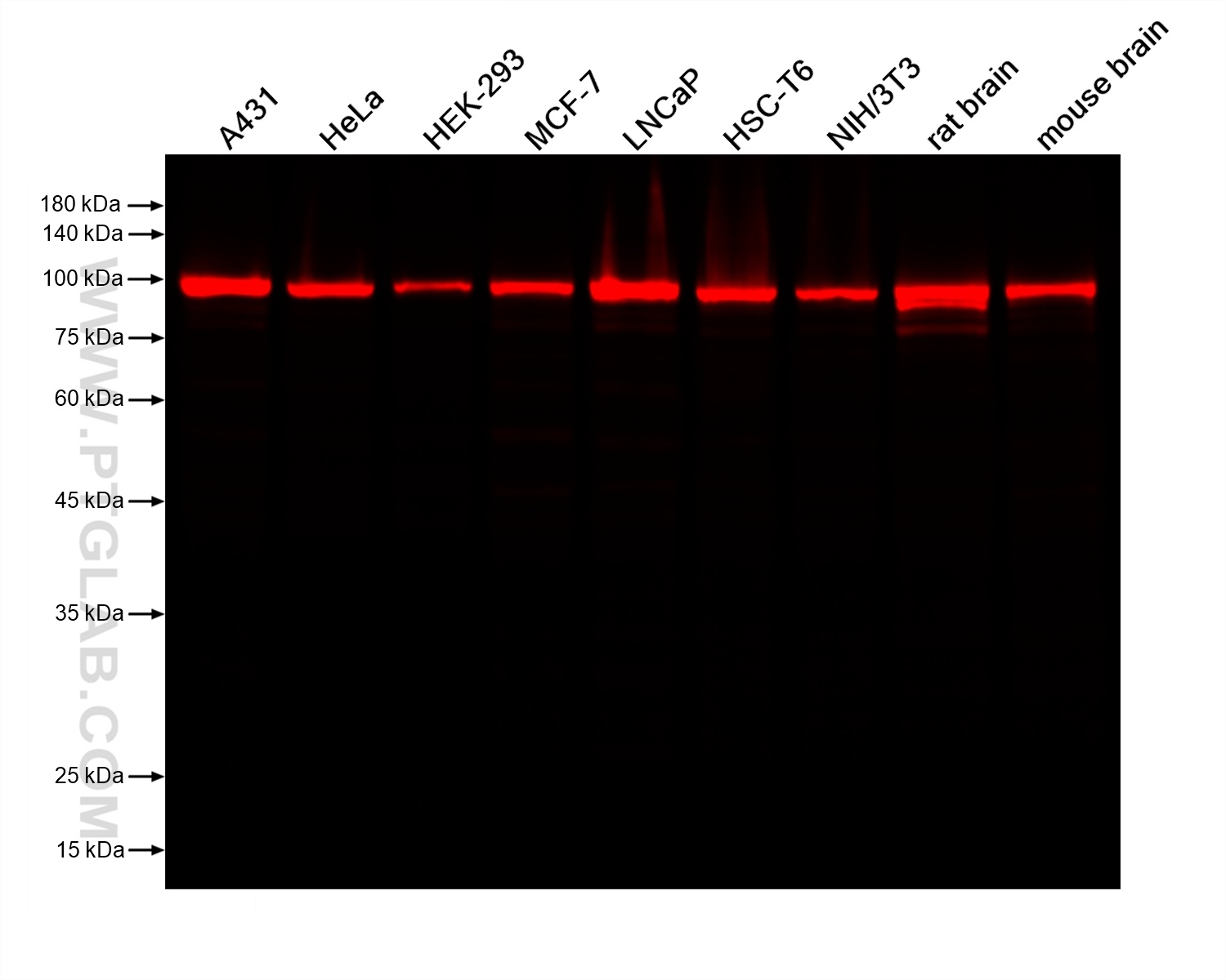 Various lysates were subjected to SDS-PAGE followed by western blot with Rabbit anti-Beta Catenin recombinant antibody (Cat.NO. 80488-1-RR) at dilution of 1:40000. Multi-rAb™ CoraLite® Plus 750-Goat Anti-Rabbit Recombinant Secondary Antibody (H+L) RGAR006 was used at 1:10000 for detection. 