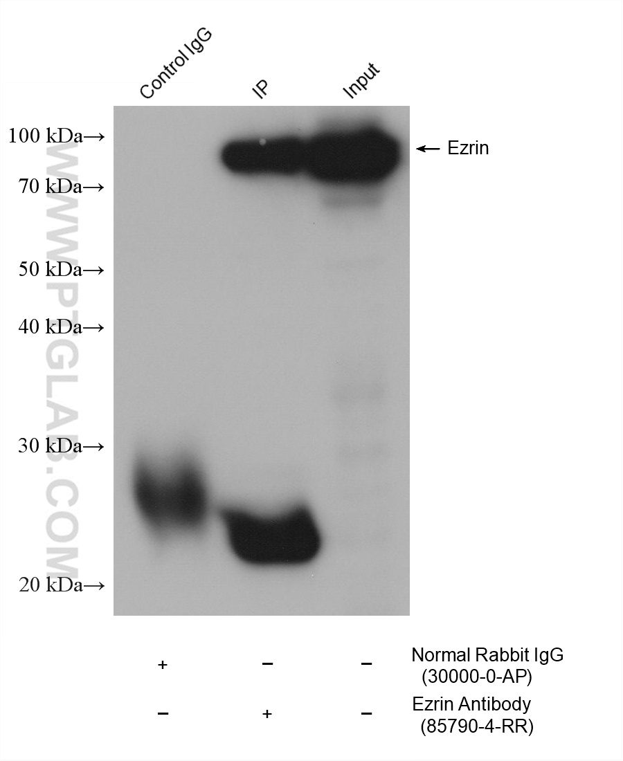 IP-WB detection with RGAR401. Lysate: HeLa cells; IP Primary: Ezrin, 85790-4-RR; IP Control: Rabbit IgG, 30000-1-AP; SDS-PAGE loading amount: 20% of IP elution and 30 μg total protein for input; WB Primary: Ezrin, 85790-4-RR, 1:3000; WB secondary: RGAR401, 1:10000. IP-WB detection with RGAR401. Lysate: HeLa cells; IP Primary: Ezrin, 85790-4-RR; IP Control: Rabbit IgG, 30000-1-AP; SDS-PAGE loading amount: 20% of IP elution and 30 μg total protein for input; WB Primary: Ezrin, 85790-4-RR, 1:3000; WB secondary: RGAR401, 1:10000.