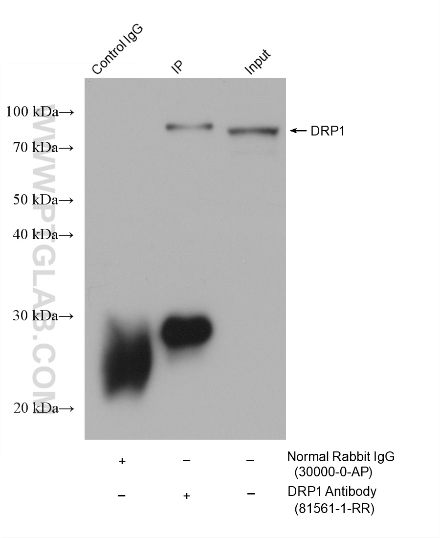 IP-WB detection with RGAR401. Lysate: Rat Brain cells; IP Primary: DRP1, 81561-1-RR; IP Control: Rabbit IgG, 30000-1-AP; SDS-PAGE loading amount: 20% of IP elution and 30 μg total protein for input; WB Primary: DRP1, 81561-1-RR, 1:50000; WB secondary: RGAR401, 1:10000. IP-WB detection with RGAR401. Lysate: Rat Brain cells; IP Primary: DRP1, 81561-1-RR; IP Control: Rabbit IgG, 30000-1-AP; SDS-PAGE loading amount: 20% of IP elution and 30 μg total protein for input; WB Primary: DRP1, 81561-1-RR, 1:50000; WB secondary: RGAR401, 1:10000.