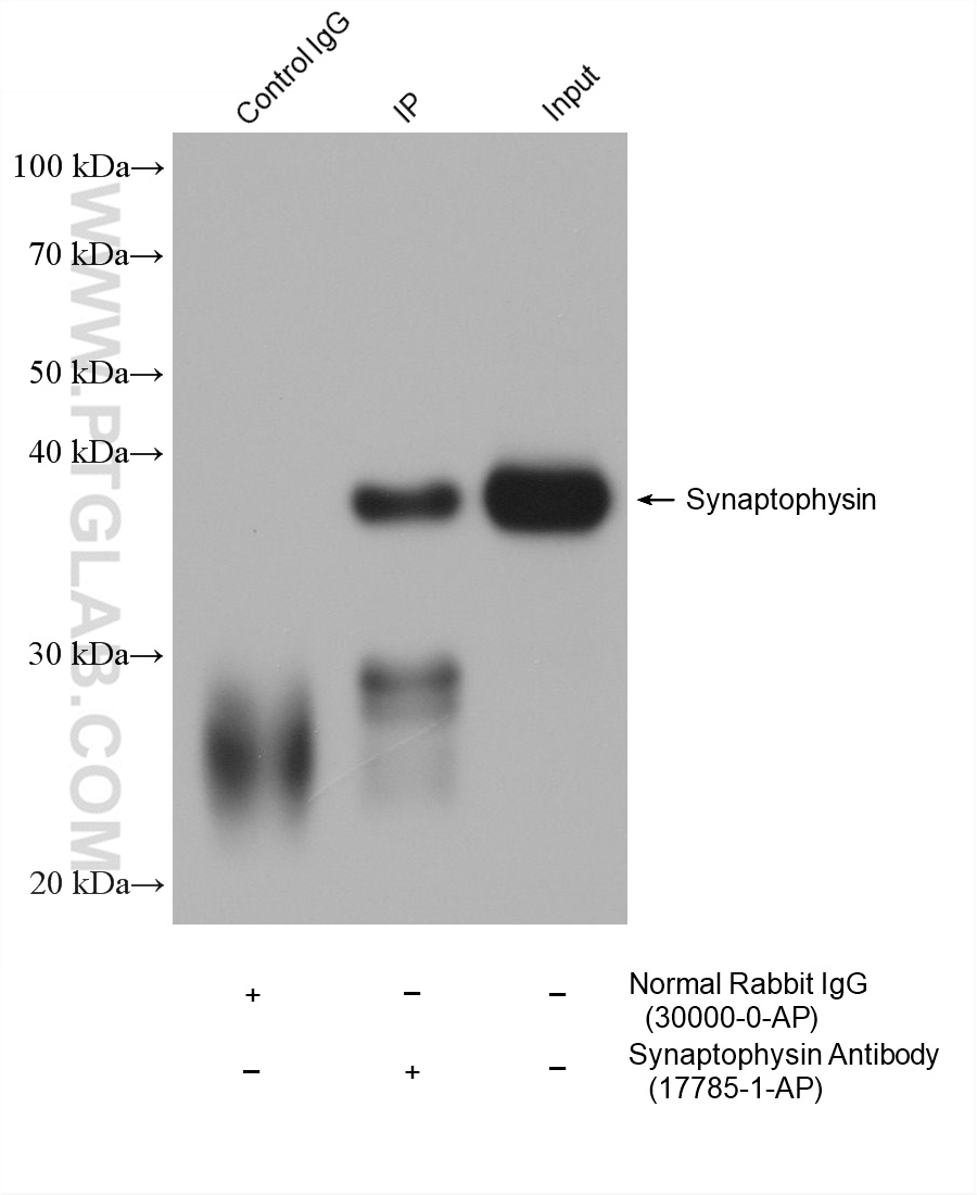 IP-WB detection with RGAR401. Lysate: Mouse Brain cells; IP Primary: Synaptophysin, 17785-1-AP; IP Control: Rabbit IgG, 30000-1-AP; SDS-PAGE loading amount: 20% of IP elution and 30 μg total protein for input; WB Primary: Synaptophysin, 17785-1-AP, 1:50000; WB secondary: RGAR401, 1:10000. IP-WB detection with RGAR401. Lysate: Mouse Brain cells; IP Primary: Synaptophysin, 17785-1-AP; IP Control: Rabbit IgG, 30000-1-AP; SDS-PAGE loading amount: 20% of IP elution and 30 μg total protein for input; WB Primary: Synaptophysin, 17785-1-AP, 1:50000; WB secondary: RGAR401, 1:10000.