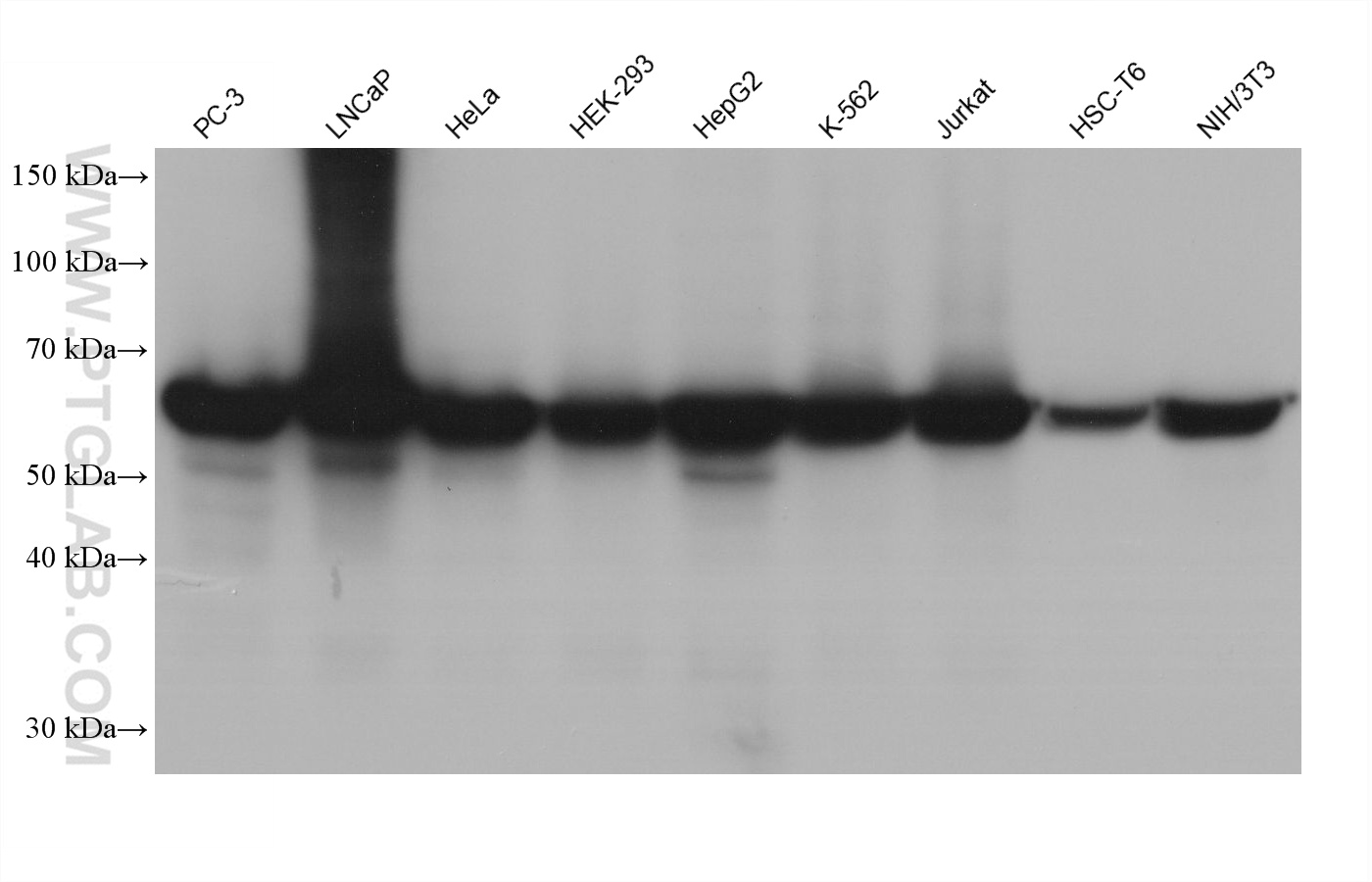 Western blot detection using RGAR401. Various lysates were subjected to SDS PAGE followed by western blot with 15282-1-AP (HSP60 antibody) at dilution of 1:100000.
HRP-Goat Anti-Rabbit IgG Light Chain Specific Recombinant Secondary Antibody #RGAR401 was used at 1:5000 for detection. Western blot detection using RGAR401. Various lysates were subjected to SDS PAGE followed by western blot with 15282-1-AP (HSP60 antibody) at dilution of 1:100000.
HRP-Goat Anti-Rabbit IgG Light Chain Specific Recombinant Secondary Antibody #RGAR401 was used at 1:5000 for detection.