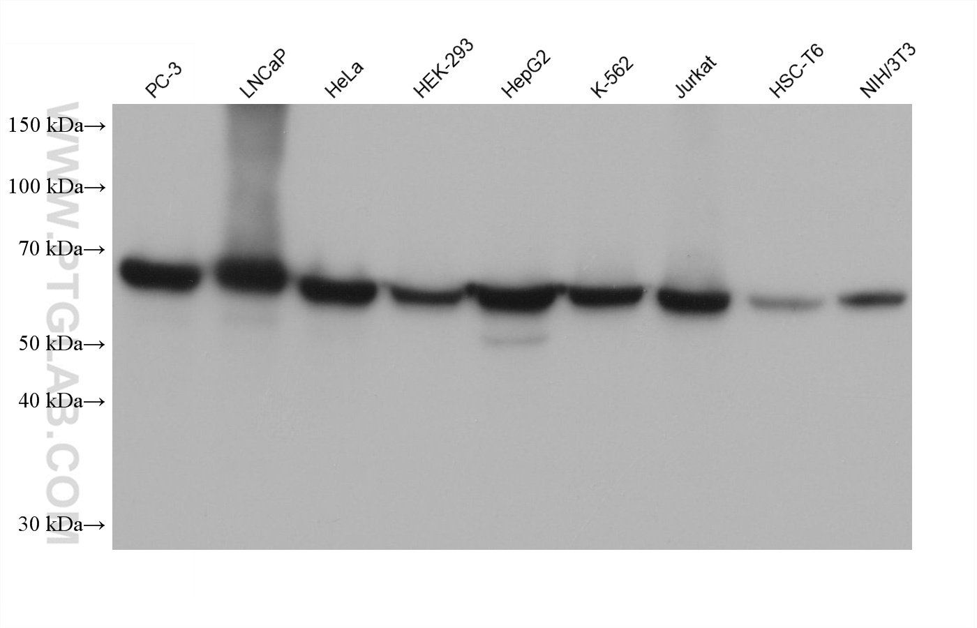 Western blot detection using RGAR401. Various lysates were subjected to SDS PAGE followed by western blot with 15282-1-AP (HSP60 antibody) at dilution of 1:100000.
HRP-Goat Anti-Rabbit IgG Light Chain Specific Recombinant Secondary Antibody #RGAR401 was used at 1:10000 for detection. Western blot detection using RGAR401. Various lysates were subjected to SDS PAGE followed by western blot with 15282-1-AP (HSP60 antibody) at dilution of 1:100000.
HRP-Goat Anti-Rabbit IgG Light Chain Specific Recombinant Secondary Antibody #RGAR401 was used at 1:10000 for detection.