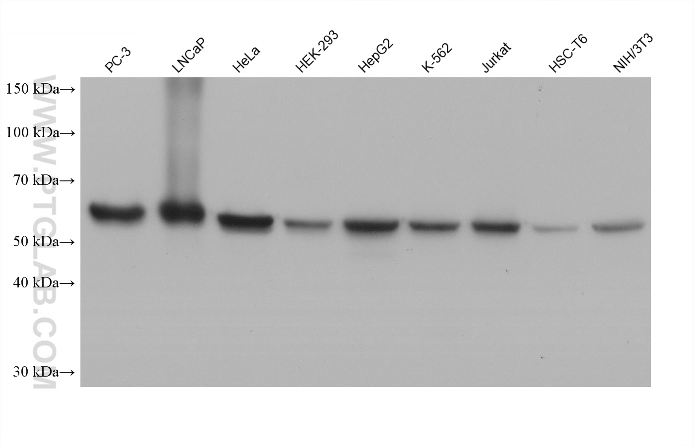 Western blot detection using RGAR401. Various lysates were subjected to SDS PAGE followed by western blot with 15282-1-AP (HSP60 antibody) at dilution of 1:100000.
HRP-Goat Anti-Rabbit IgG Light Chain Specific Recombinant Secondary Antibody #RGAR401 was used at 1:20000 for detection. Western blot detection using RGAR401. Various lysates were subjected to SDS PAGE followed by western blot with 15282-1-AP (HSP60 antibody) at dilution of 1:100000.
HRP-Goat Anti-Rabbit IgG Light Chain Specific Recombinant Secondary Antibody #RGAR401 was used at 1:20000 for detection.
