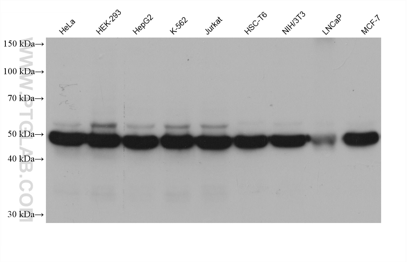Western blot detection using RGAR401. Various lysates were subjected to SDS PAGE followed by western blot with 80713-1-RR (Beta Tubulin antibody) at dilution of 1:20000.
HRP-Goat Anti-Rabbit IgG Light Chain Specific Recombinant Secondary Antibody #RGAR401 was used at 1:5000 for detection. Western blot detection using RGAR401. Various lysates were subjected to SDS PAGE followed by western blot with 80713-1-RR (Beta Tubulin antibody) at dilution of 1:20000.
HRP-Goat Anti-Rabbit IgG Light Chain Specific Recombinant Secondary Antibody #RGAR401 was used at 1:5000 for detection.