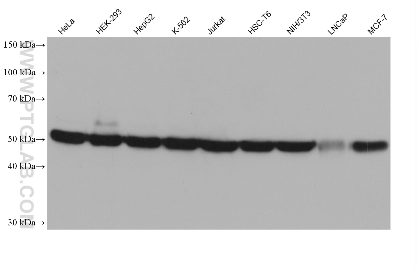Western blot detection using RGAR401. Various lysates were subjected to SDS PAGE followed by western blot with 80713-1-RR (Beta Tubulin antibody) at dilution of 1:20000.
HRP-Goat Anti-Rabbit IgG Light Chain Specific Recombinant Secondary Antibody #RGAR401 was used at 1:20000 for detection. Western blot detection using RGAR401. Various lysates were subjected to SDS PAGE followed by western blot with 80713-1-RR (Beta Tubulin antibody) at dilution of 1:20000.
HRP-Goat Anti-Rabbit IgG Light Chain Specific Recombinant Secondary Antibody #RGAR401 was used at 1:20000 for detection.