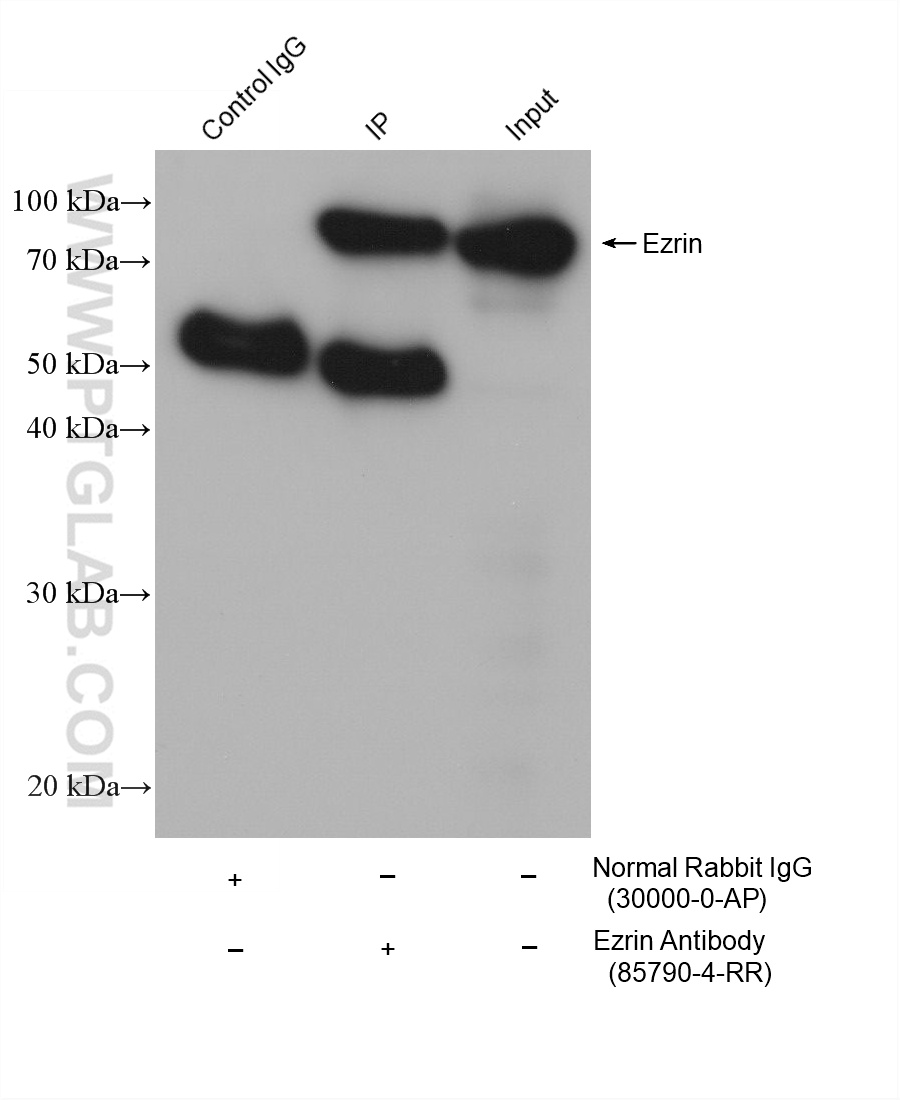 IP-WB detection with RGAR501. Lysate: HeLa cells; IP Primary: Ezrin, 85790-4-RR; IP Control: Rabbit IgG, 30000-1-AP; SDS-PAGE loading amount: 20% of IP elution and 30 μg total protein for input; WB Primary: Ezrin, 85790-4-RR, 1:3000; WB secondary: RGAR501, 1:10000. IP-WB detection with RGAR501. Lysate: HeLa cells; IP Primary: Ezrin, 85790-4-RR; IP Control: Rabbit IgG, 30000-1-AP; SDS-PAGE loading amount: 20% of IP elution and 30 μg total protein for input; WB Primary: Ezrin, 85790-4-RR, 1:3000; WB secondary: RGAR501, 1:10000.