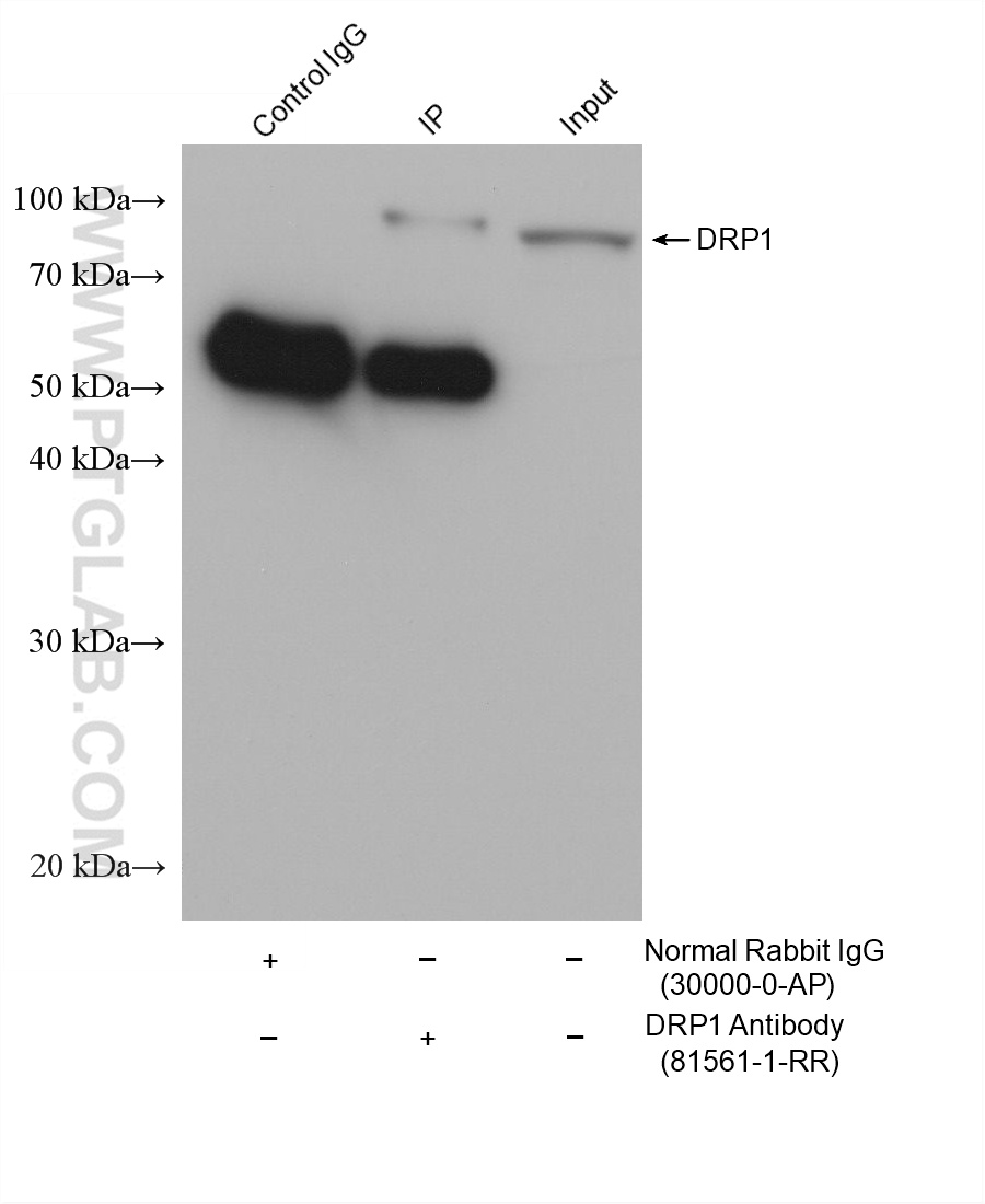 IP-WB detection with RGAR501. Lysate: Rat Brain cells; IP Primary: DRP1, 81561-1-RR; IP Control: Rabbit IgG, 30000-1-AP; SDS-PAGE loading amount: 20% of IP elution and 30 μg total protein for input; WB Primary: DRP1, 81561-1-RR, 1:50000; WB secondary: RGAR501, 1:10000. IP-WB detection with RGAR501. Lysate: Rat Brain cells; IP Primary: DRP1, 81561-1-RR; IP Control: Rabbit IgG, 30000-1-AP; SDS-PAGE loading amount: 20% of IP elution and 30 μg total protein for input; WB Primary: DRP1, 81561-1-RR, 1:50000; WB secondary: RGAR501, 1:10000.
