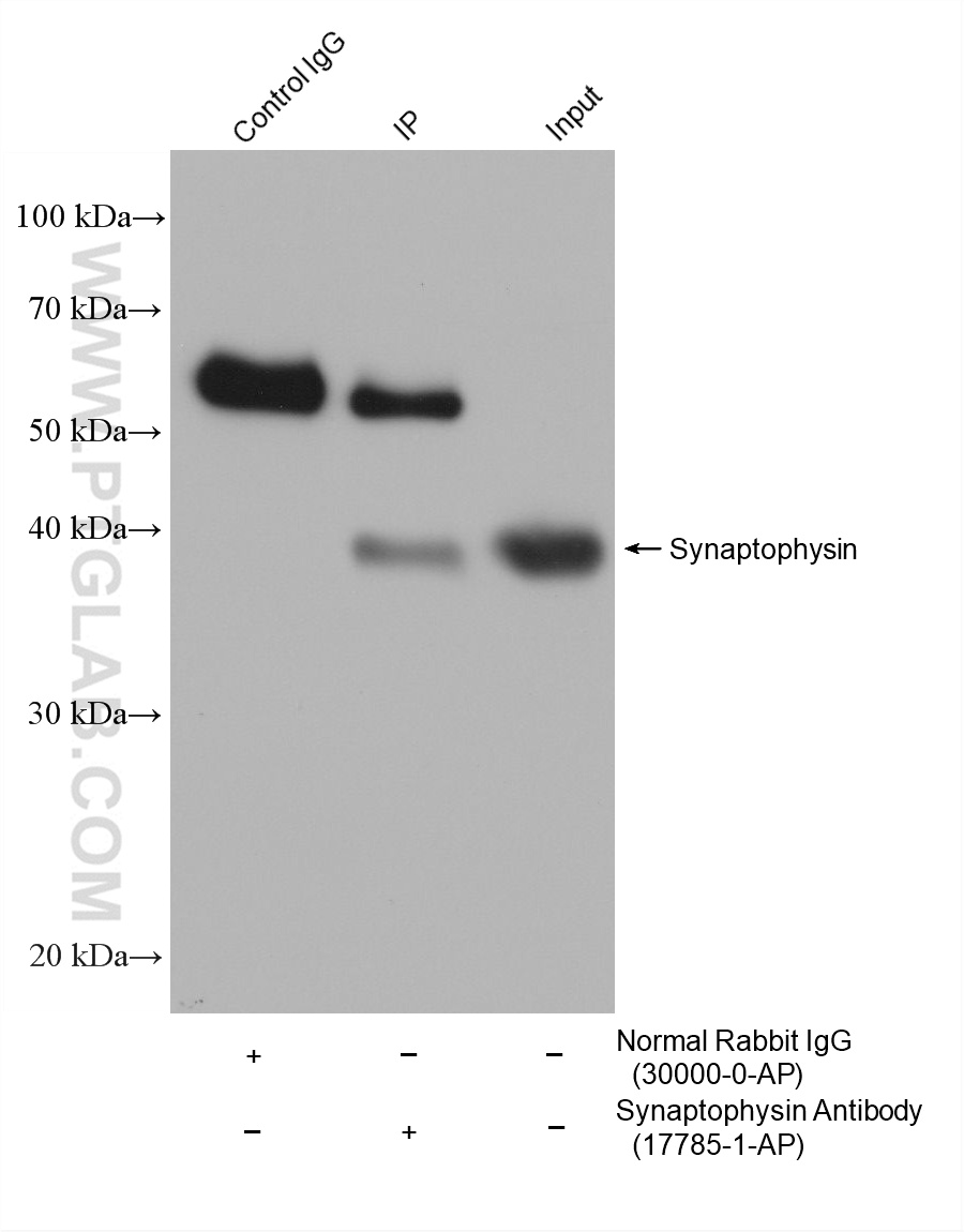 IP-WB detection with RGAR501. Lysate: Mouse Brain cells; IP Primary: Synaptophysin, 17785-1-AP; IP Control: Rabbit IgG, 30000-1-AP; SDS-PAGE loading amount: 20% of IP elution and 30 μg total protein for input; WB Primary: Synaptophysin, 17785-1-AP, 1:50000; WB secondary: RGAR501, 1:10000. IP-WB detection with RGAR501. Lysate: Mouse Brain cells; IP Primary: Synaptophysin, 17785-1-AP; IP Control: Rabbit IgG, 30000-1-AP; SDS-PAGE loading amount: 20% of IP elution and 30 μg total protein for input; WB Primary: Synaptophysin, 17785-1-AP, 1:50000; WB secondary: RGAR501, 1:10000.