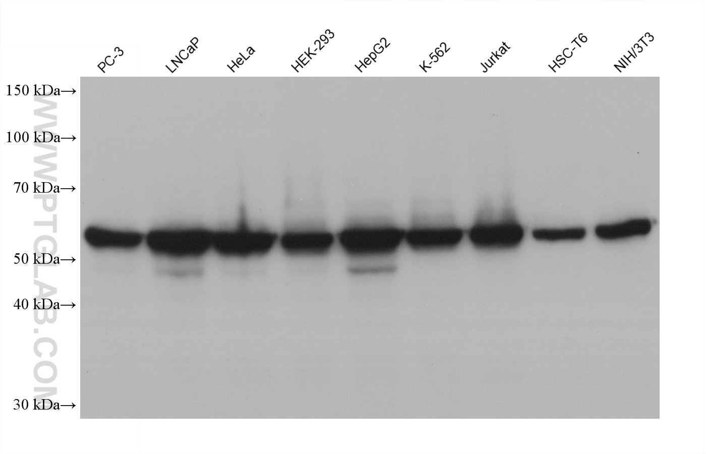 Western blot detection using RGAR501. Various lysates were subjected to SDS PAGE followed by western blot with 15282-1-AP (HSP60 antibody) at dilution of 1:100000.
HRP-Goat Anti-Rabbit IgG Heavy Chain Specific Recombinant Secondary Antibody #RGA501 was used at 1:5000 for detection. Western blot detection using RGAR501. Various lysates were subjected to SDS PAGE followed by western blot with 15282-1-AP (HSP60 antibody) at dilution of 1:100000.
HRP-Goat Anti-Rabbit IgG Heavy Chain Specific Recombinant Secondary Antibody #RGA501 was used at 1:5000 for detection.