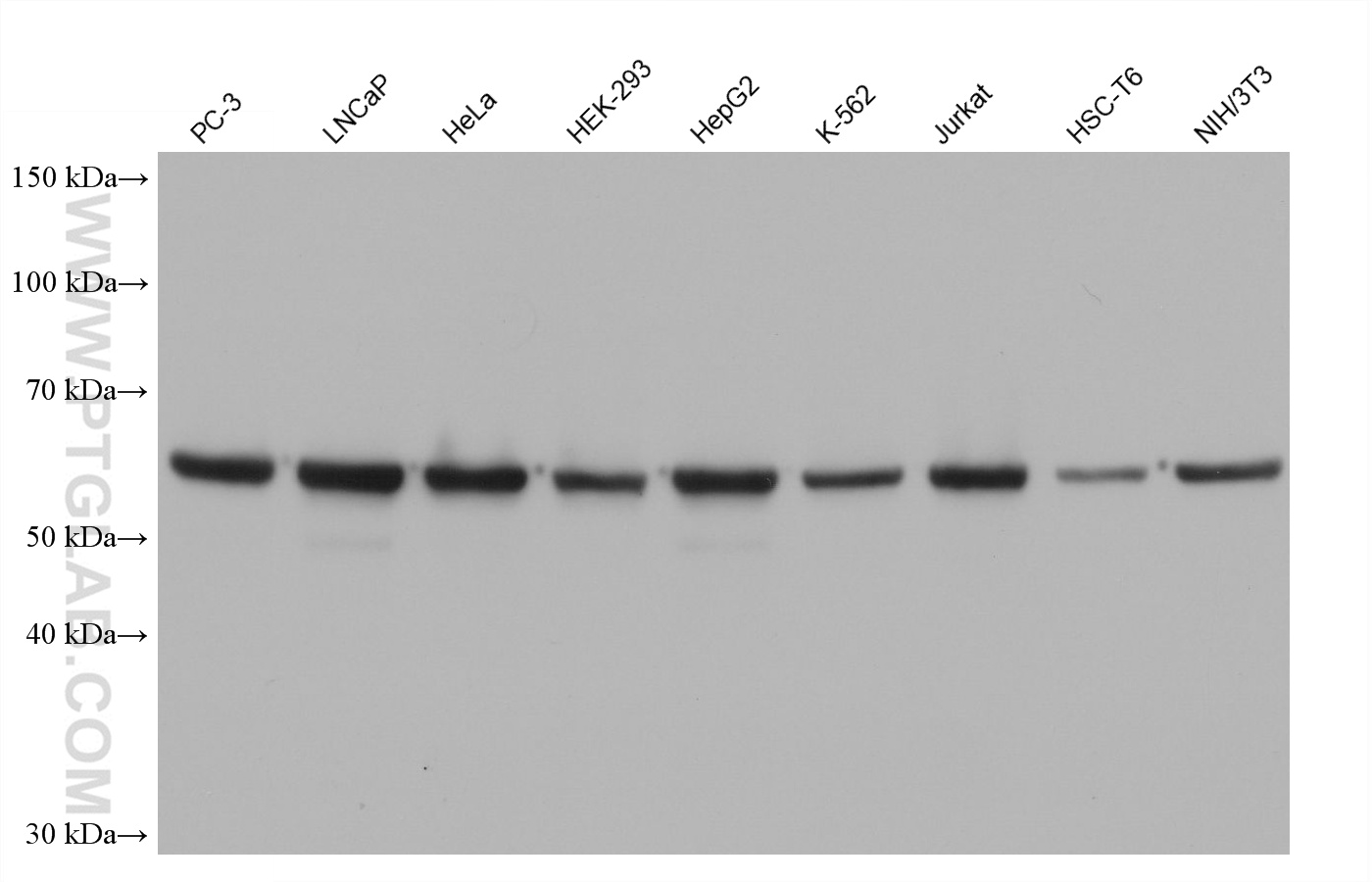 Western blot detection using RGAR501. Various lysates were subjected to SDS PAGE followed by western blot with 15282-1-AP (HSP60 antibody) at dilution of 1:100000.
HRP-Goat Anti-Rabbit IgG Heavy Chain Specific Recombinant Secondary Antibody #RGAR501 was used at 1:10000 for detection. Western blot detection using RGAR501. Various lysates were subjected to SDS PAGE followed by western blot with 15282-1-AP (HSP60 antibody) at dilution of 1:100000.
HRP-Goat Anti-Rabbit IgG Heavy Chain Specific Recombinant Secondary Antibody #RGAR501 was used at 1:10000 for detection.