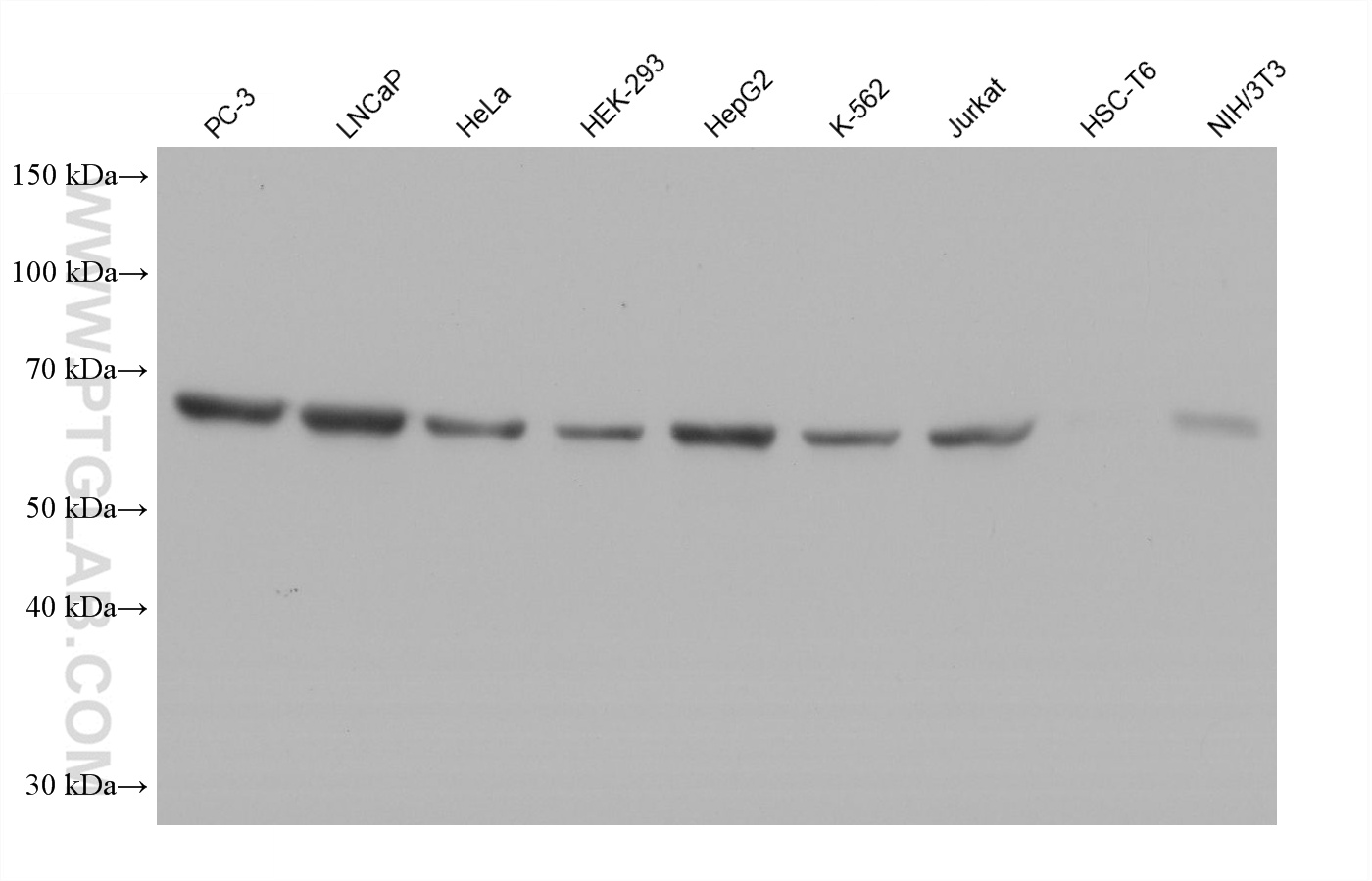 Western blot detection using RGAR501. Various lysates were subjected to SDS PAGE followed by western blot with 15282-1-AP (HSP60 antibody) at dilution of 1:100000.
HRP-Goat Anti-Rabbit IgG Heavy Chain Specific Recombinant Secondary Antibody #RGAR501 was used at 1:20000 for detection. Western blot detection using RGAR501. Various lysates were subjected to SDS PAGE followed by western blot with 15282-1-AP (HSP60 antibody) at dilution of 1:100000.
HRP-Goat Anti-Rabbit IgG Heavy Chain Specific Recombinant Secondary Antibody #RGAR501 was used at 1:20000 for detection.